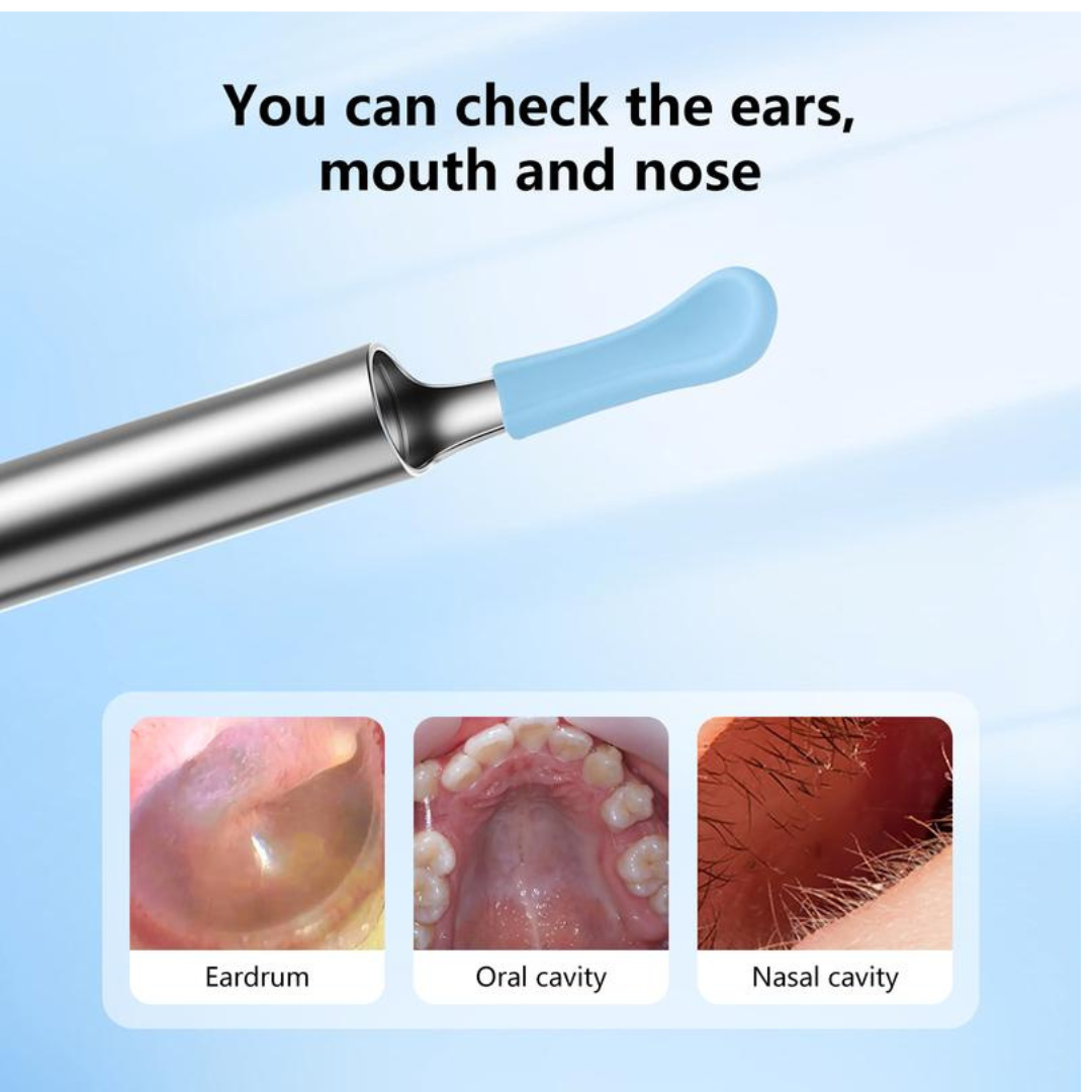 NovaScope™ Ear Wax Removal Tool With Camera