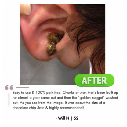 OtoFlush™ Electric Ear Wax Removal Kit