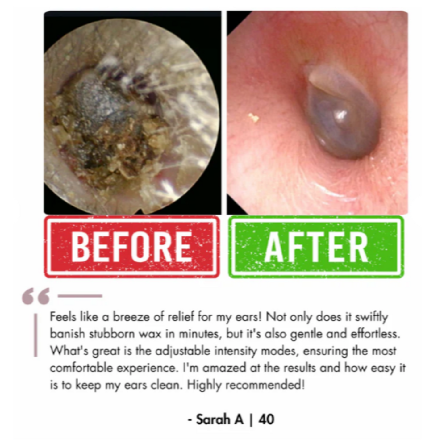 OtoFlush™ Electric Ear Wax Removal Kit