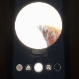 NovaScope™ Ear Wax Removal Tool With Camera