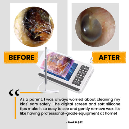 Advanced Digital Ear-Cleaner